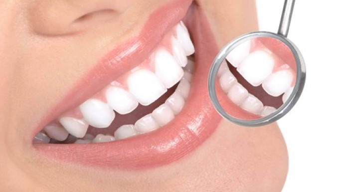 Profesionálne bielenie zubov bez peroxidu!