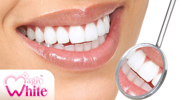 Bezperoxidové bielenie zubov v trvaní 20 minút pre 1 osobu za 15 €